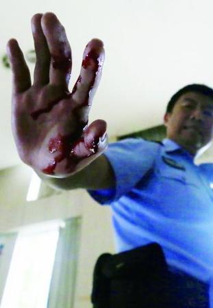 　由于培訓(xùn)全是真刀真槍，一民警的手被“匪徒”砍傷 攝 法制晚報(bào)記者 曹博遠(yuǎn)