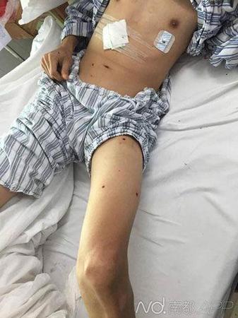 中槍傷者躺在病床上。