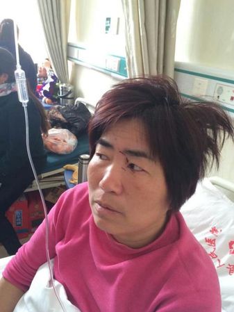 孫以民說，其妻子攔在他前面，和對方有撕扯，妻子被打傷。 孫以民 供圖