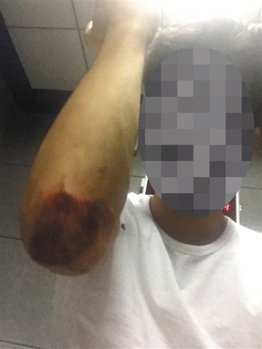 被警方抓捕時，不知情的黃誠進行了反抗，導致胳膊肘擦傷。