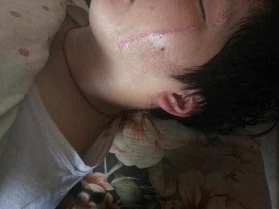 男生與同學(xué)產(chǎn)生口角被按地上刀割雙臉 老師不在場