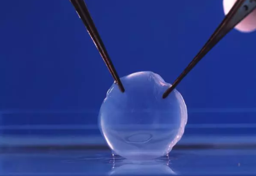 視力突然下降 為什么要移植角膜？