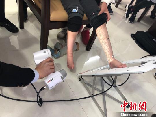 圖為技師使用紅外激光掃描取樣。(資料圖) 徐雪 攝