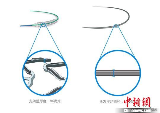 火鷹支架壁的凹槽與頭發(fā)直徑對(duì)比圖。　供圖 攝