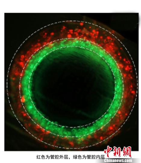 中美醫(yī)學(xué)專家攜手取得3D生物打印新進(jìn)展